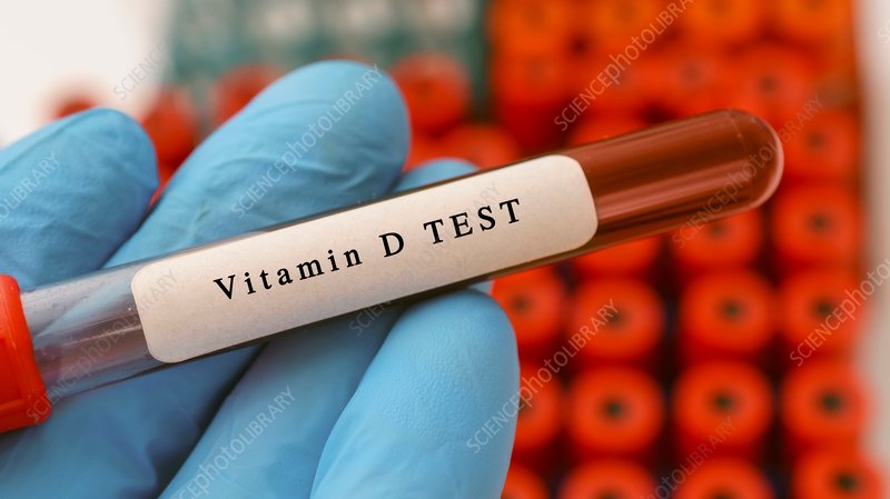 Vitamin D Test