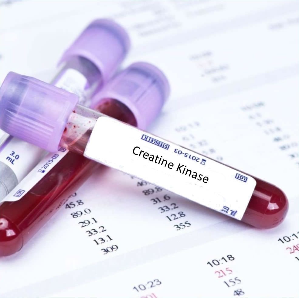 Creatine Kinase (CK) Test